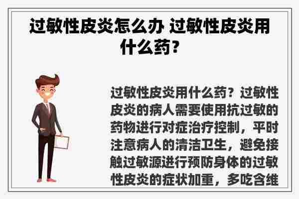 过敏性皮炎怎么办 过敏性皮炎用什么药？